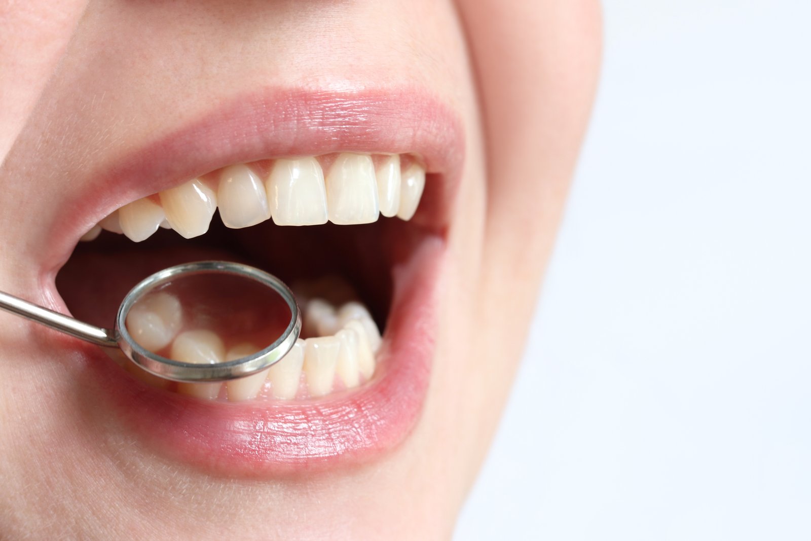 Rehabilitación Oral - Dra. Angie Villa